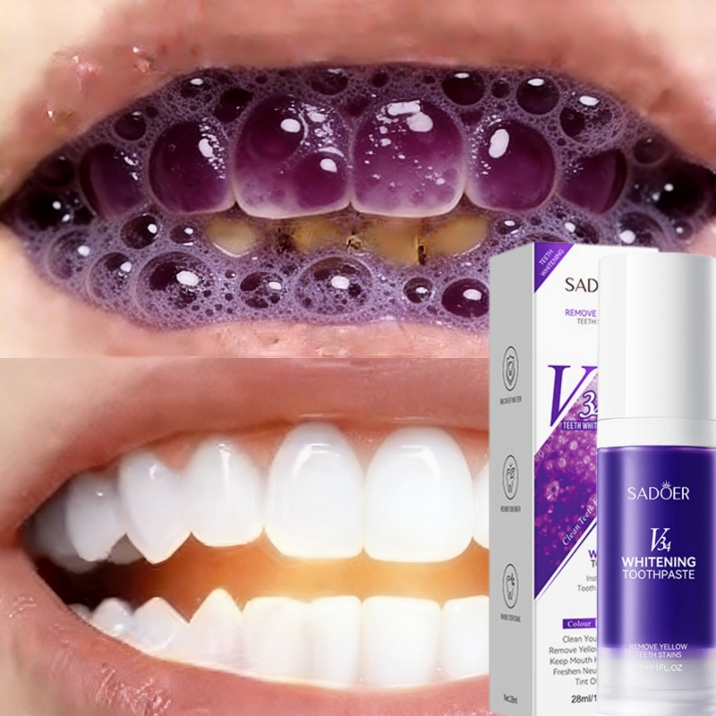 Teeth Whitening Effective - Bestverkochte whitening tandpasta 2026, verwijdert effectief