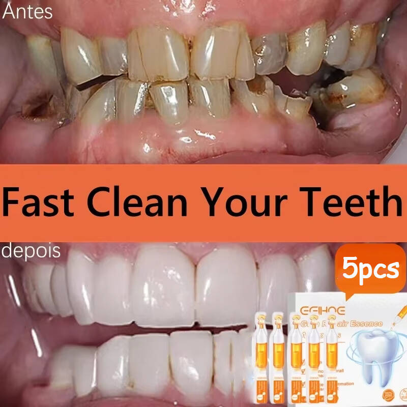 Teeth Whitening Baking Soda - Snel Reparatie Tandvlees Serum Verlichten Terughoudend