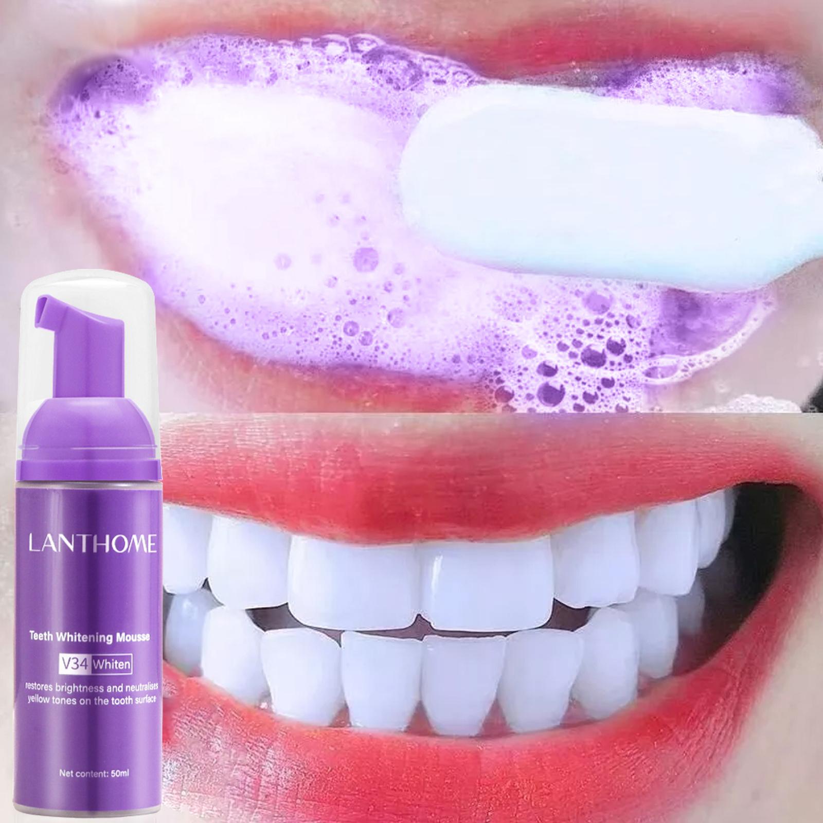 Teeth Whitening Effective - V34 Mousse Tanden Reinigen Tandpasta Effectieve