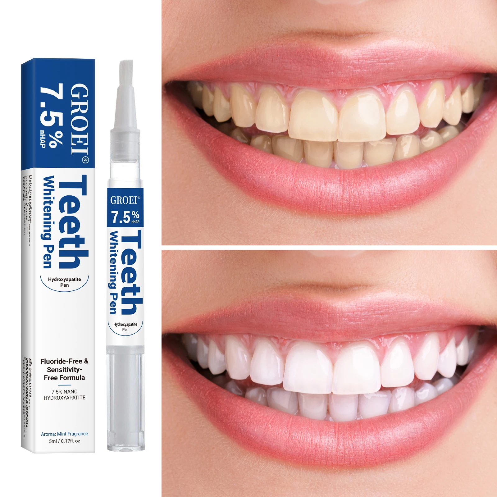 Hydroxyapatite Tand Whitening  - Teeth Whitening Gels Used By Dentists recensie en prijs