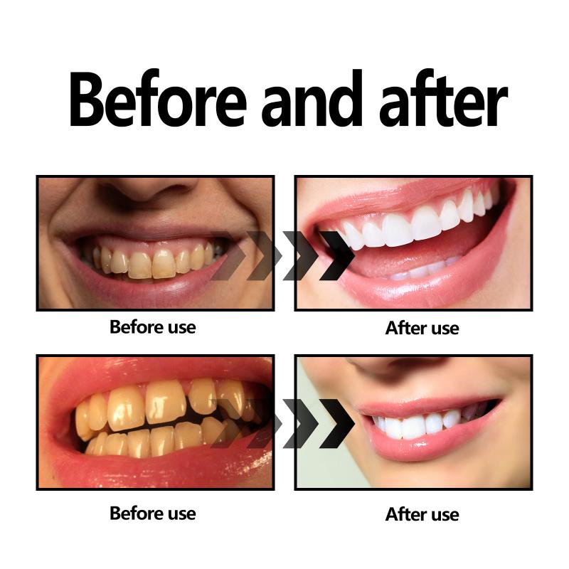 Tandenbleekpoeder Houtskool /  - Teeth Whitening Baking Soda recensie en prijs