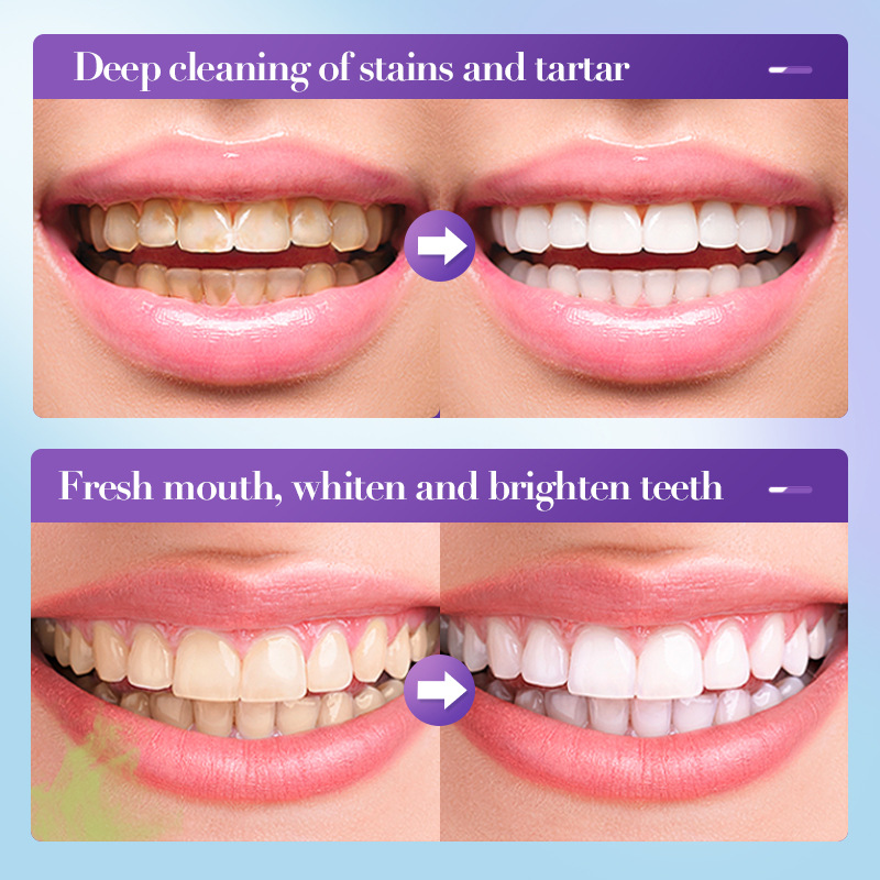Bestverkochte whitening tandpa - Teeth Whitening Effective recensie en prijs
