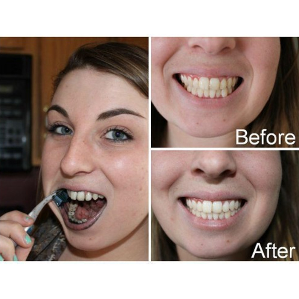 Bamboe Houtskool Tanden Dental - Teeth Whitening Charcoal Powder recensie en prijs
