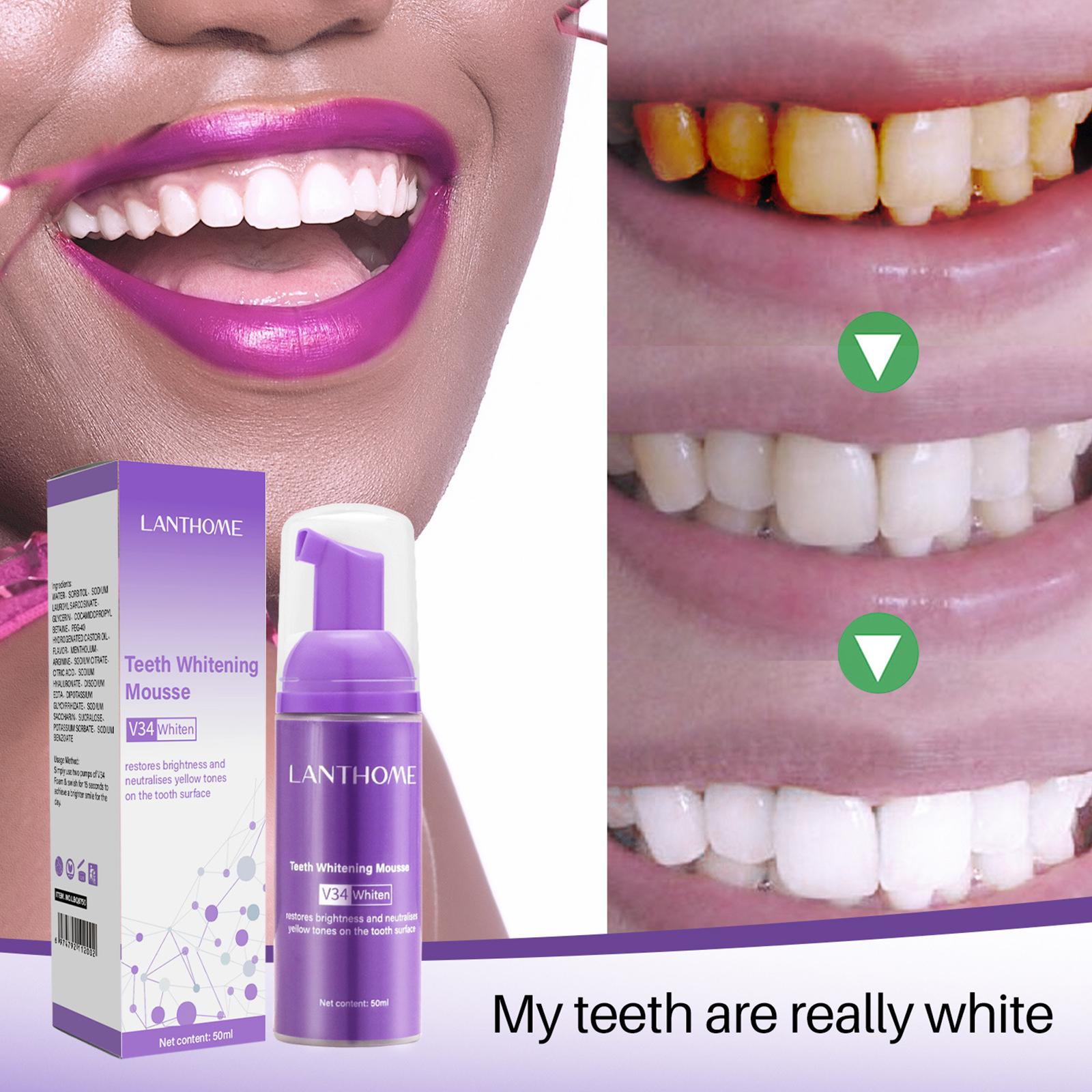 V34 Mousse Tanden Reinigen Tan - Teeth Whitening Effective recensie en prijs