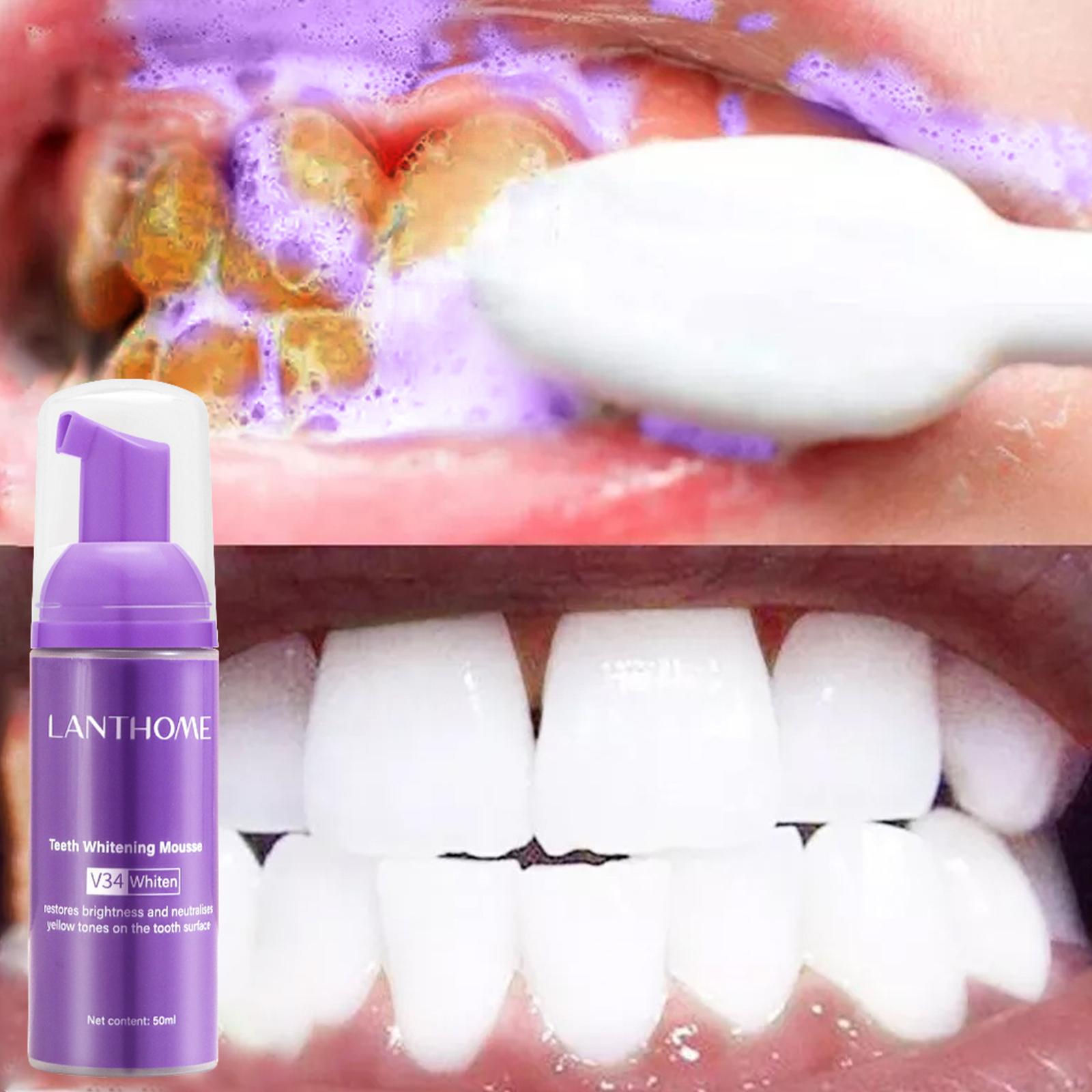 V34 Mousse Tanden Reinigen Tan - Teeth Whitening Effective recensie en prijs