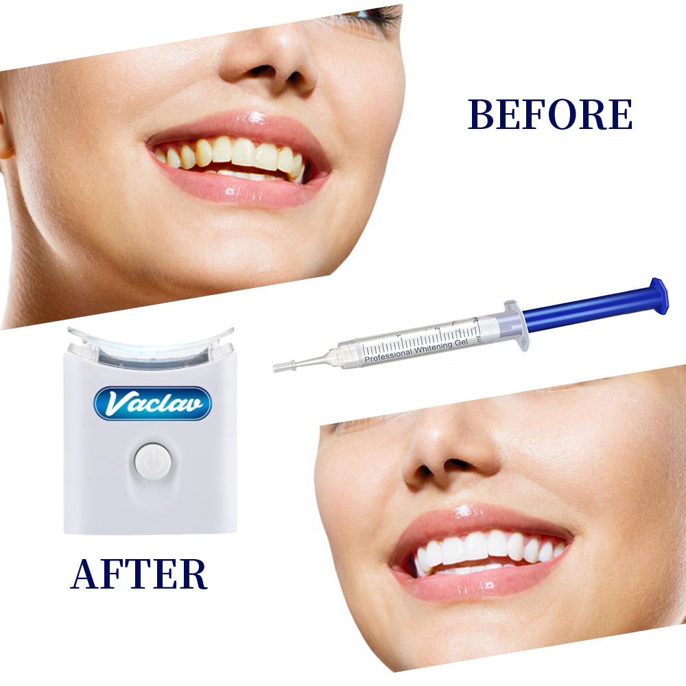 Mint Tanden Whitening Gel Spui - Teeth Whitening Baking Soda recensie en prijs