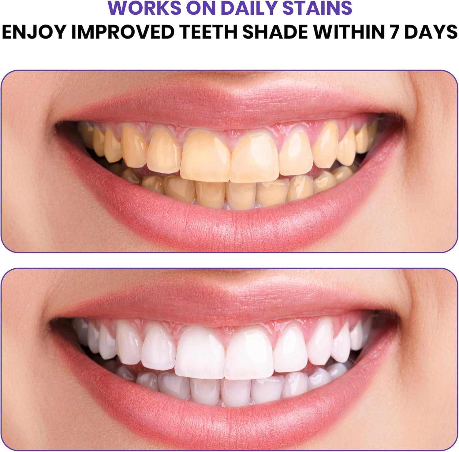 Geavanceerde paarse tandenblee - Teeth Whitening In Office recensie en prijs