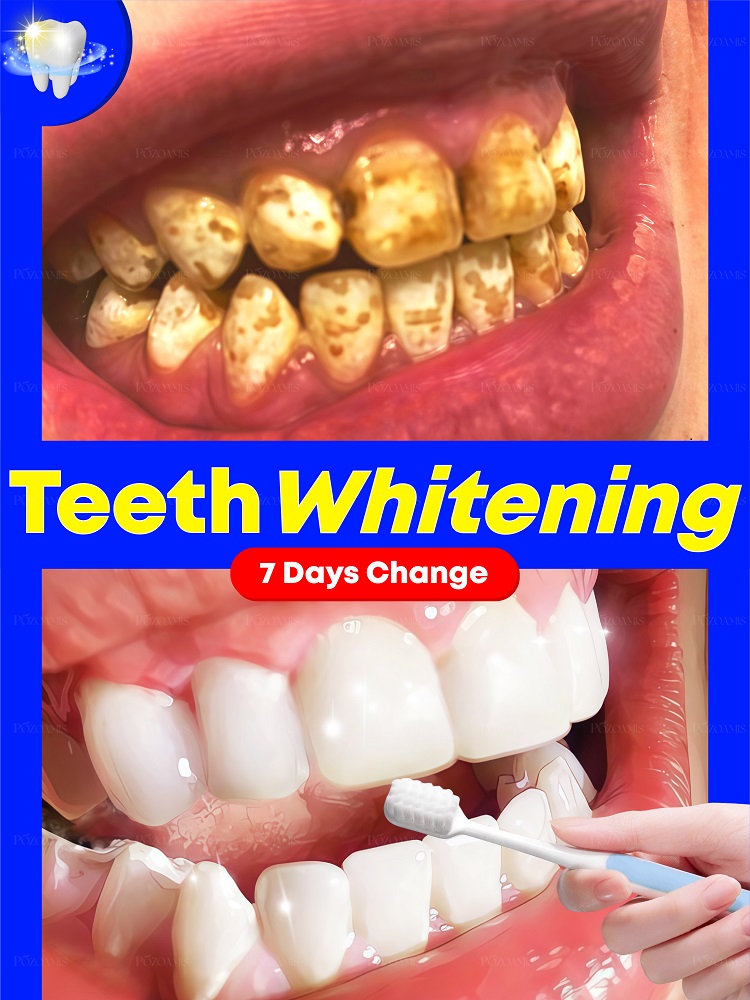 Nieuwe zwarte technologie uit  - Teeth Whitening Effective recensie en prijs