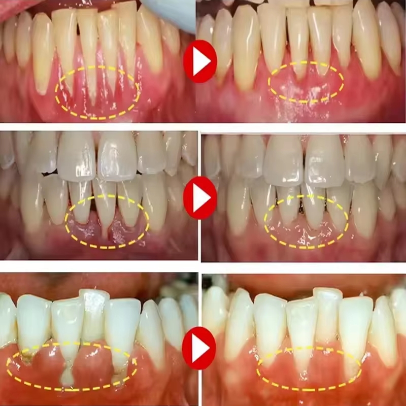 Tandenbleekgel Tandvleesrepara - Teeth Whitening Toothpaste recensie en prijs