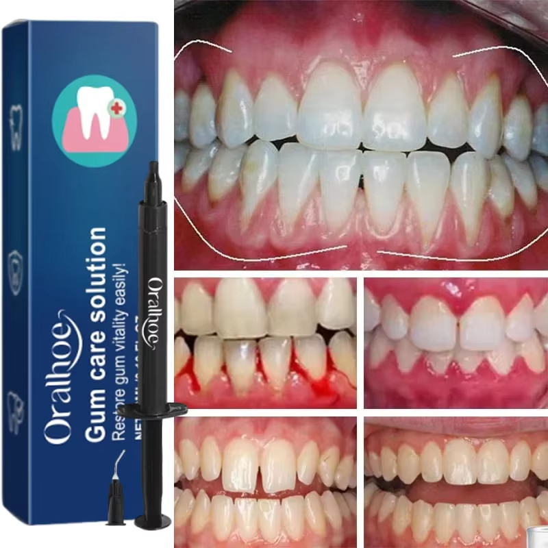 Tandenbleekgel Tandvleesrepara - Teeth Whitening Toothpaste recensie en prijs