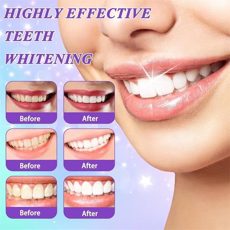 9D Paarse Tandenbleek Tandpast - Teeth Whitening Toothpaste recensie en prijs