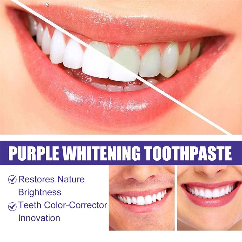 9D Paarse Tandenbleek Tandpast - Teeth Whitening Toothpaste recensie en prijs