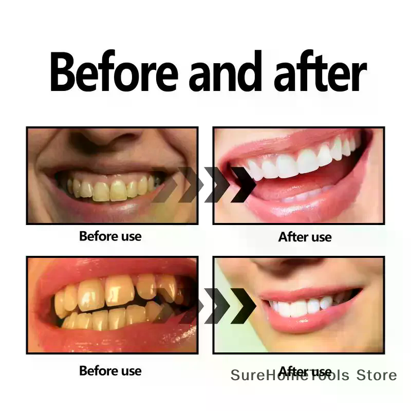 Bamboehoutskoolpoeder voor tan - Teeth Whitening Charcoal Powder recensie en prijs