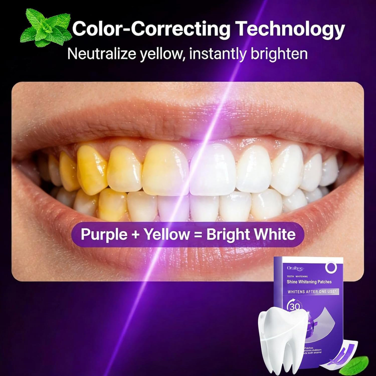 Paarse tandenbleek-comboset –  - Teeth Whitening In Office recensie en prijs