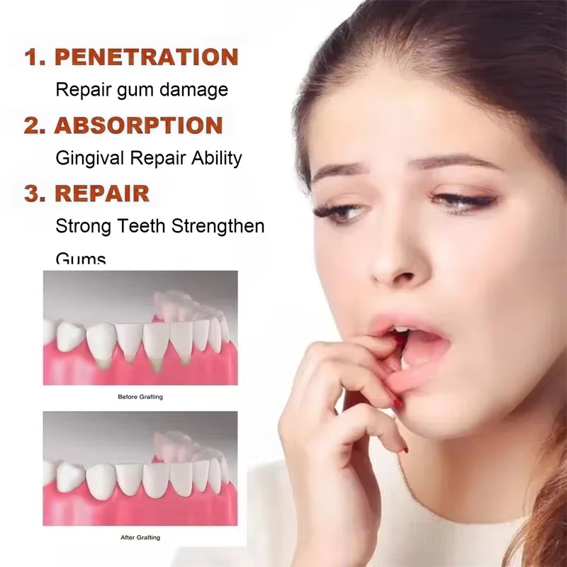 Rapid Repair Gums Serum Verlic - Teeth Whitening Foam recensie en prijs
