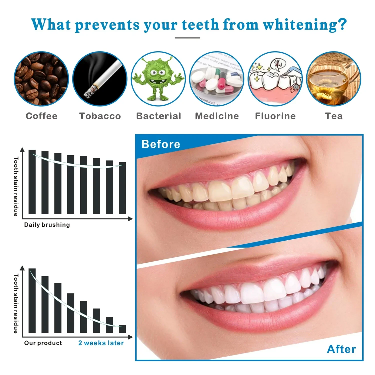 14/28pcs 3D Tanden Whitening S - Teeth Whitening Effects recensie en prijs
