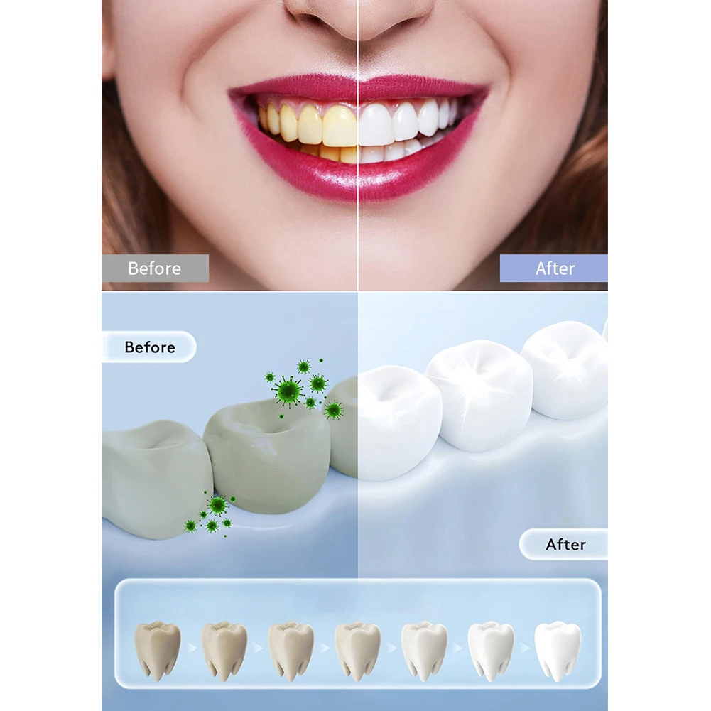 1PC Huishoudelijke Smart LED T - Teeth Whitening In Office recensie en prijs