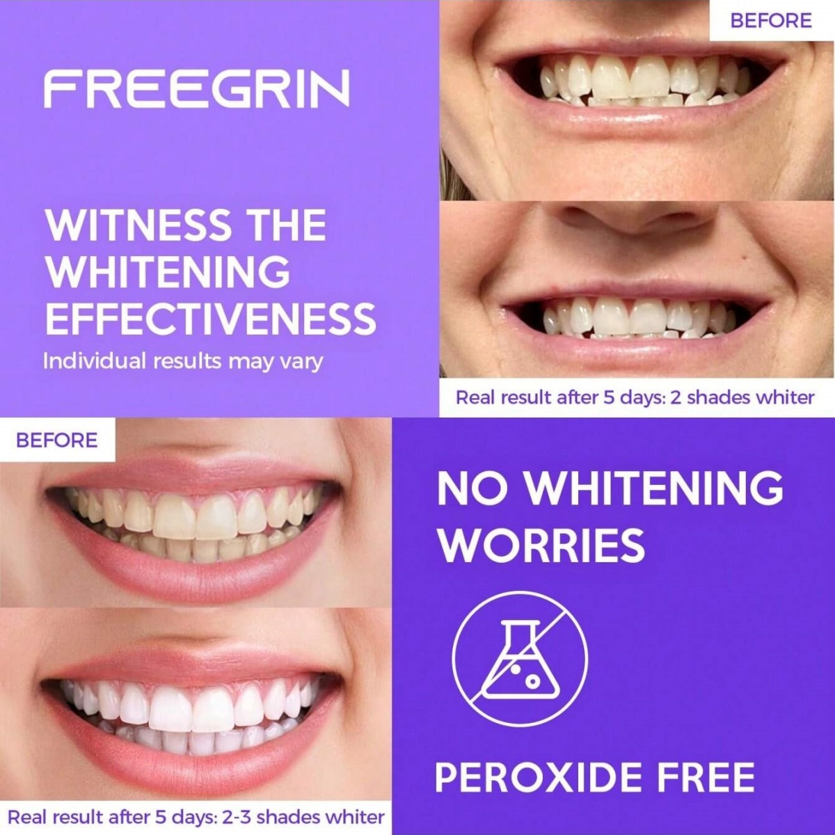 Deluxe Tanden Whitening Sticke - Teeth Whitening In Office recensie en prijs