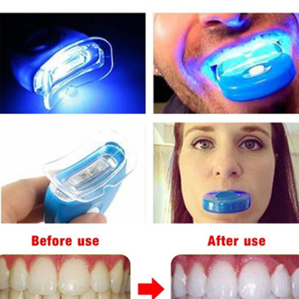 Nieuwe Blauwe Led Tanden Bleke - Teeth Whitening In Office recensie en prijs